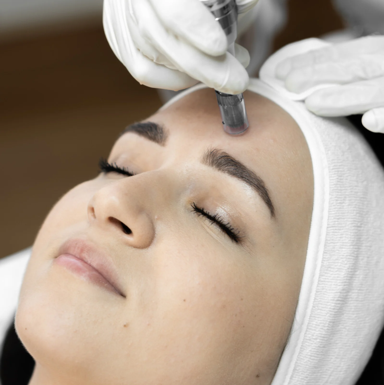 Soins de la peau - Microneedling