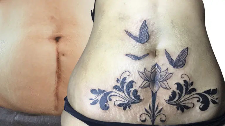 Tatouer sur une cicatrice : lesquelles peut-on recouvrir, et comment