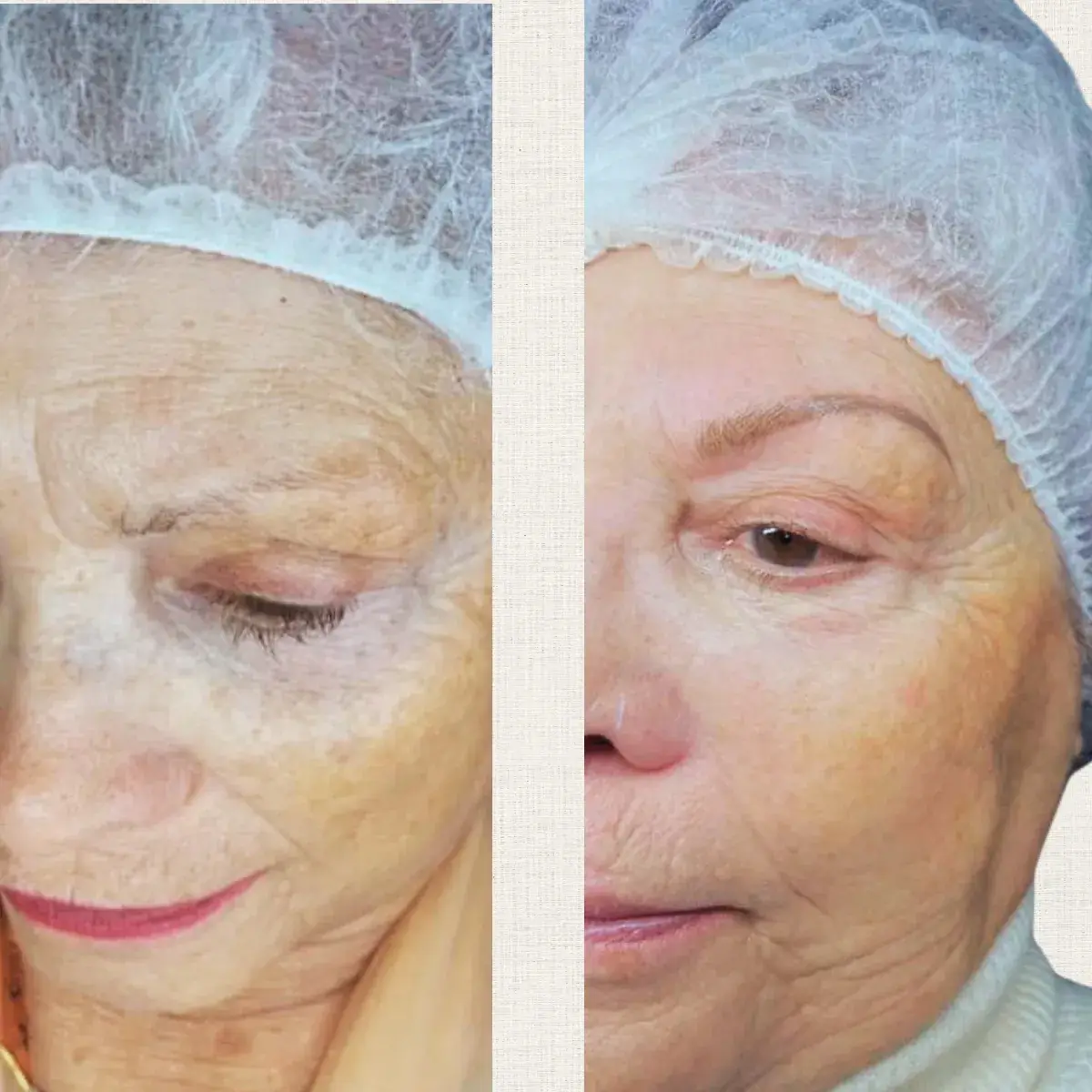 Portfolio Kanea Toulon