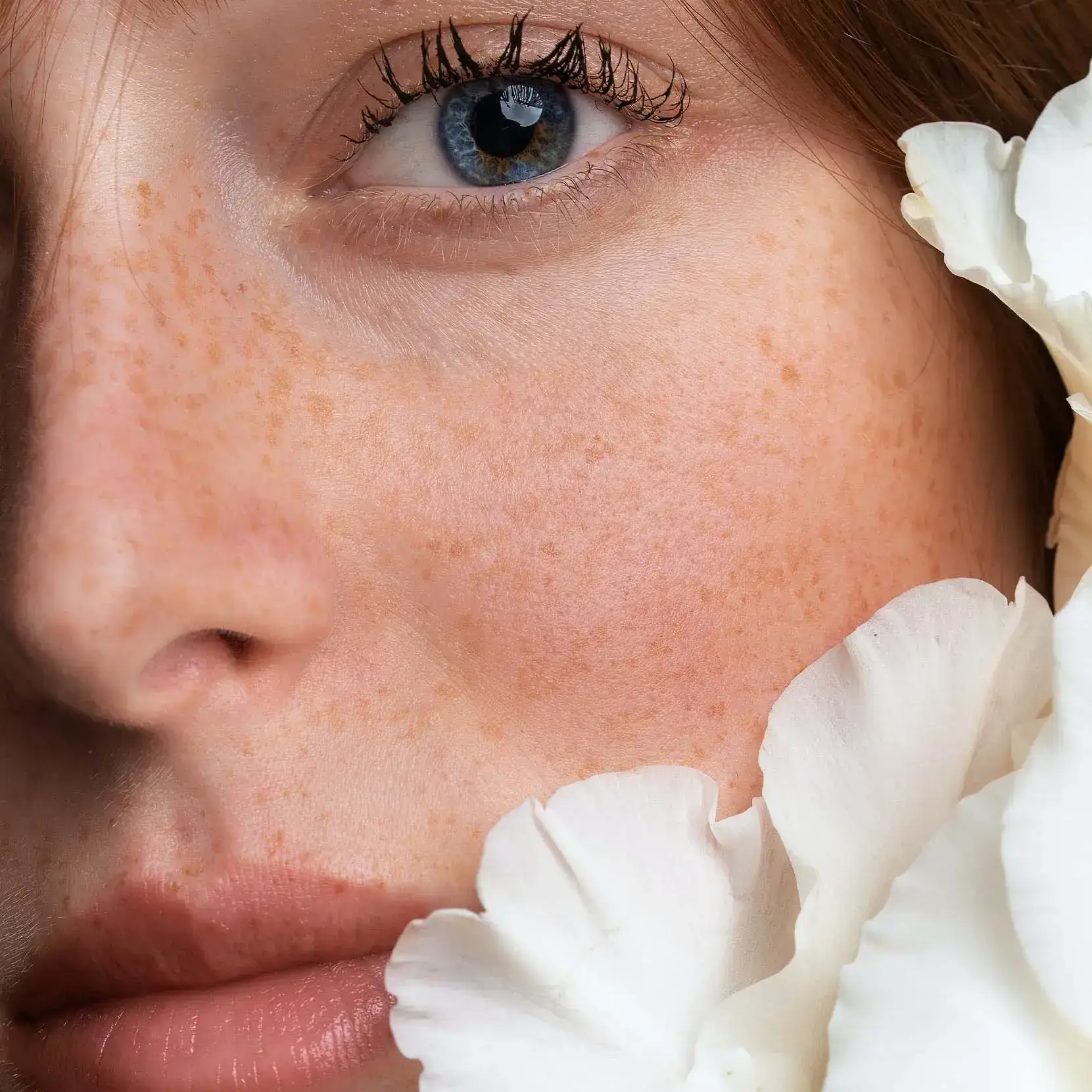 Taches de rousseur en maquillage permanent, résultat naturel, Kanea Toulon
