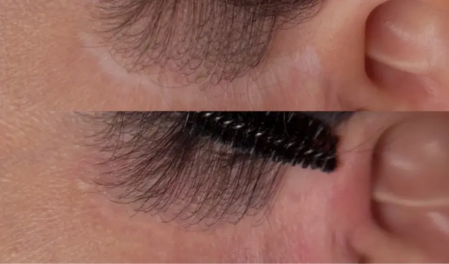 Nanopigmentation camouflage cicatrice à Toulon : pigments médicaux Biotic Phocéa, méthode VGlow Kelen Bauck, soin réparateur sans chirurgie