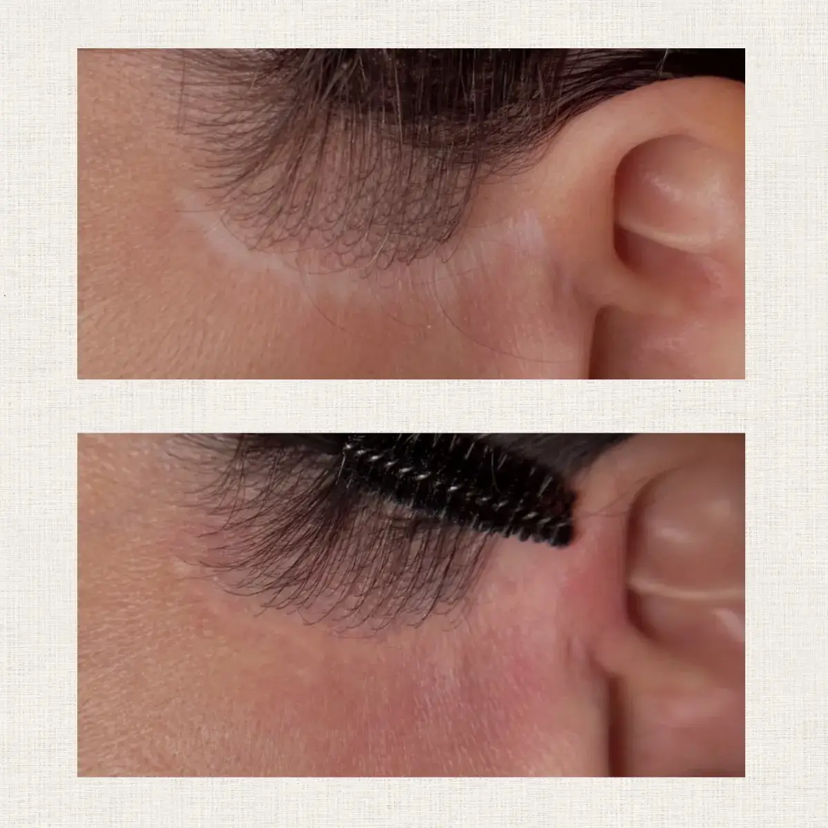 Portfolio nanopigmentation Kanea Toulon