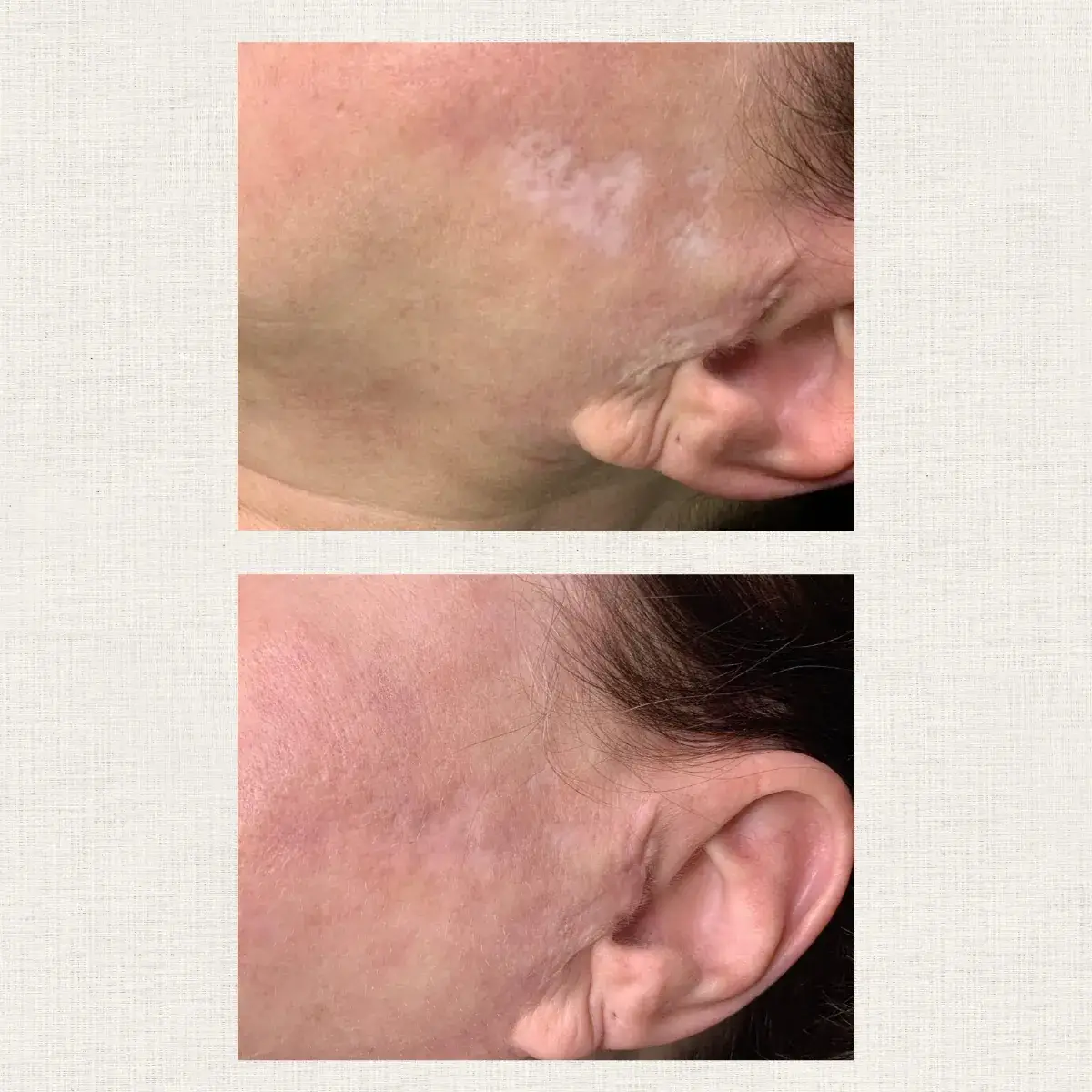 Tâches Kanea Toulon