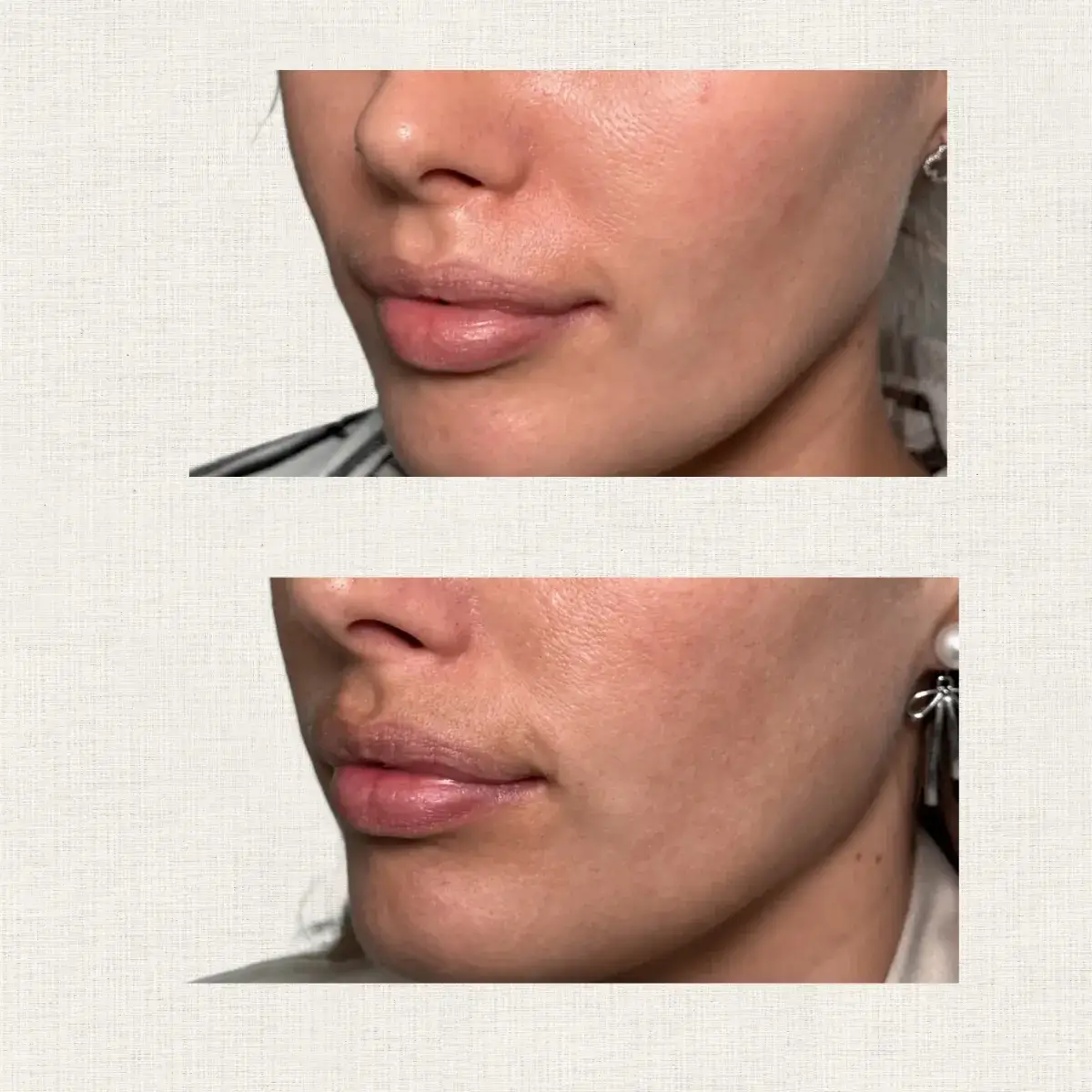 Glow — teint lumineux Kanea Toulon