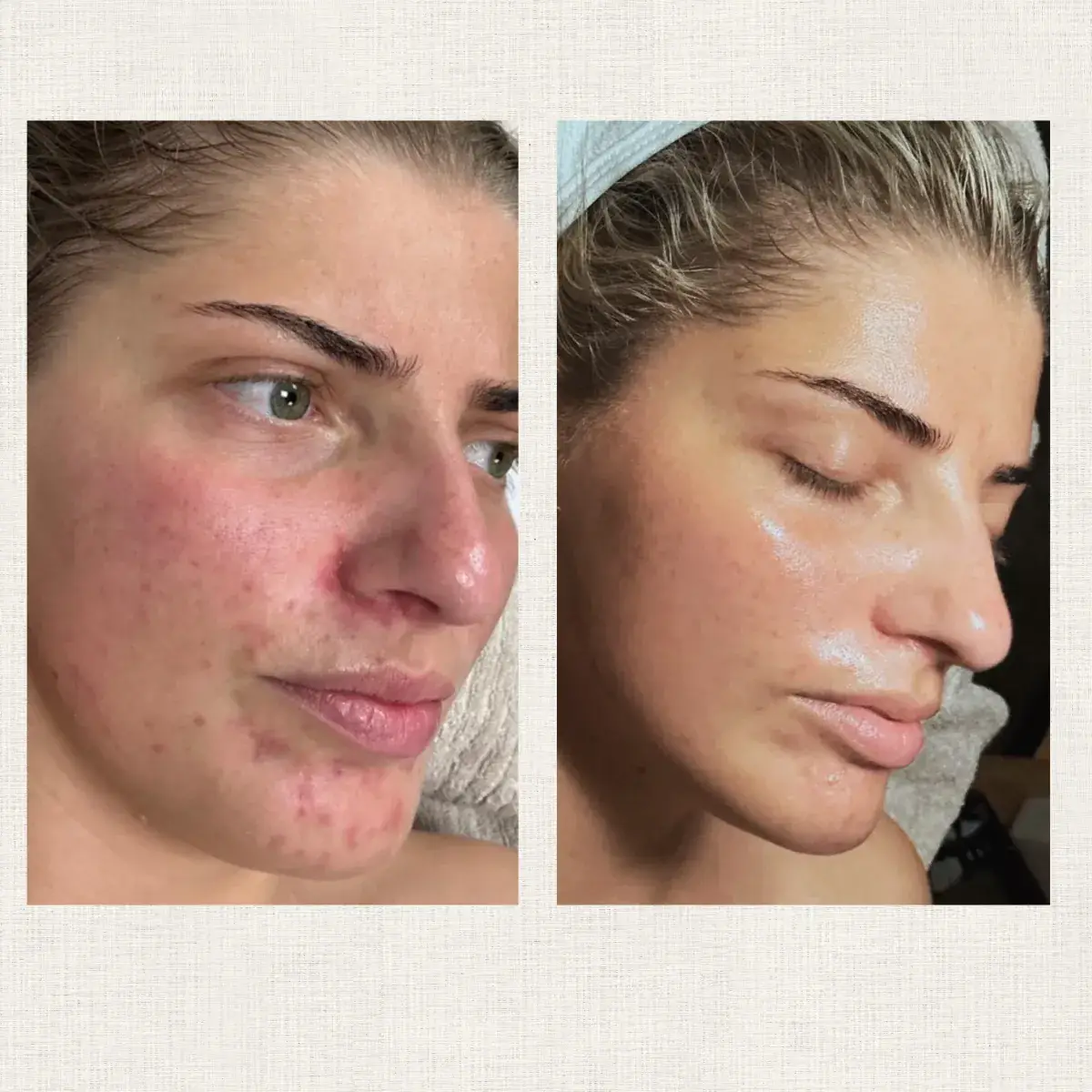 Portfolio Kanea Toulon