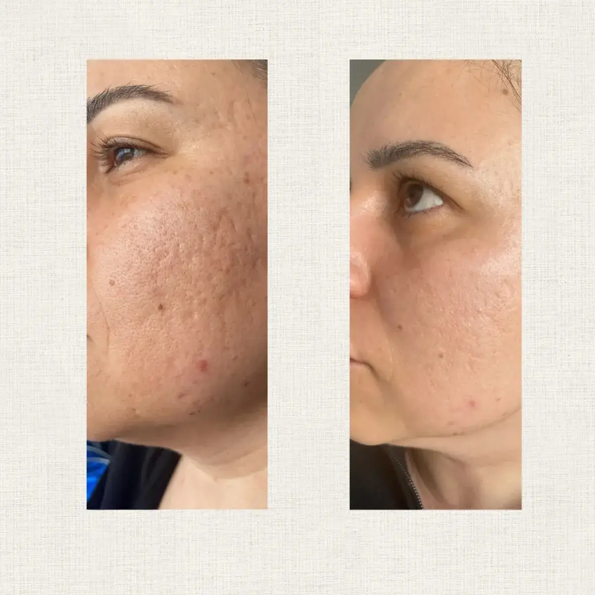 Portfolio Kanea Toulon