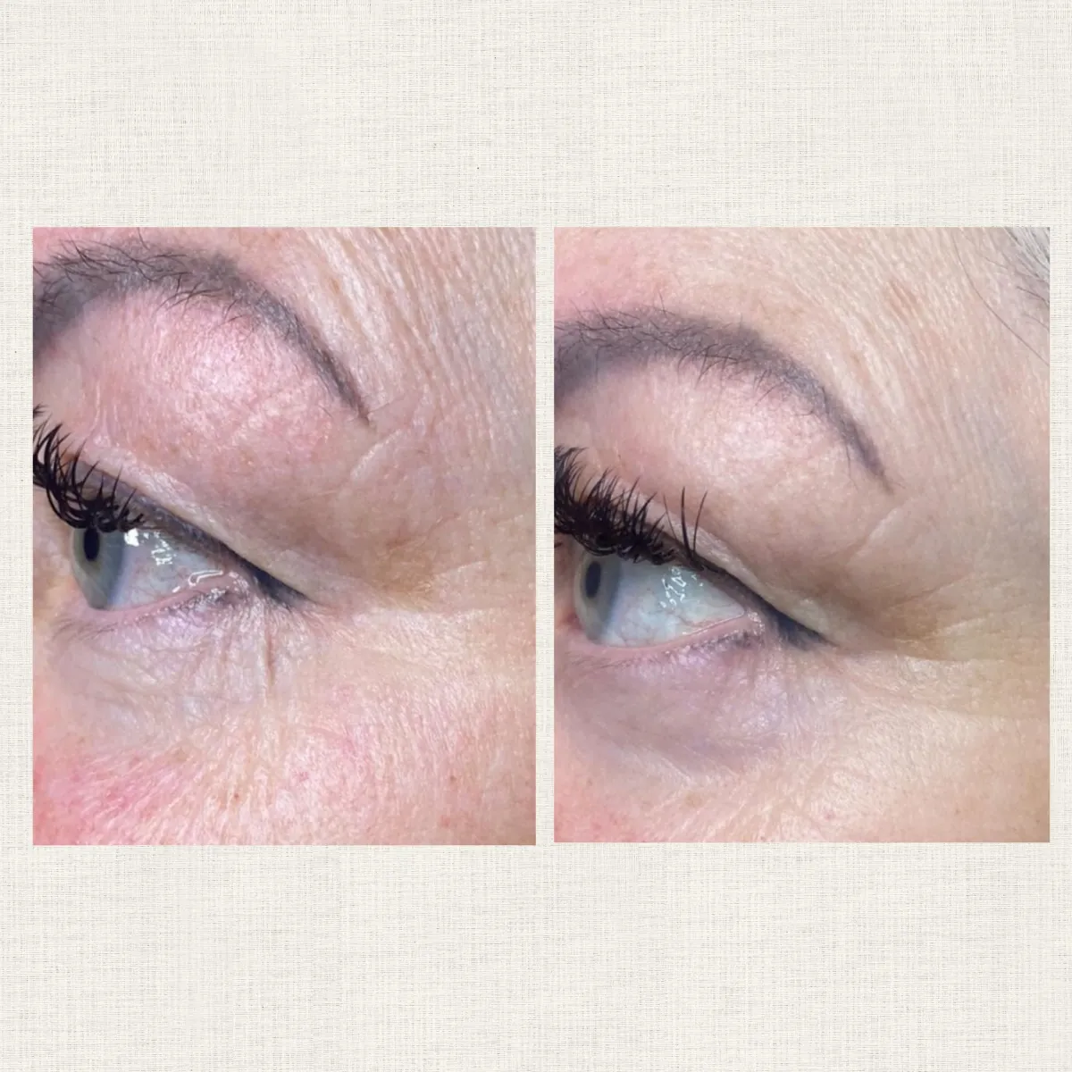 Portfolio Kanea Toulon