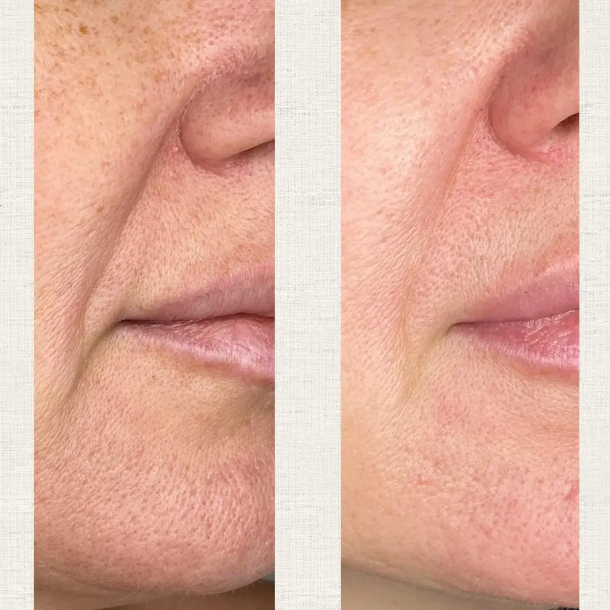 Portfolio Kanea Toulon