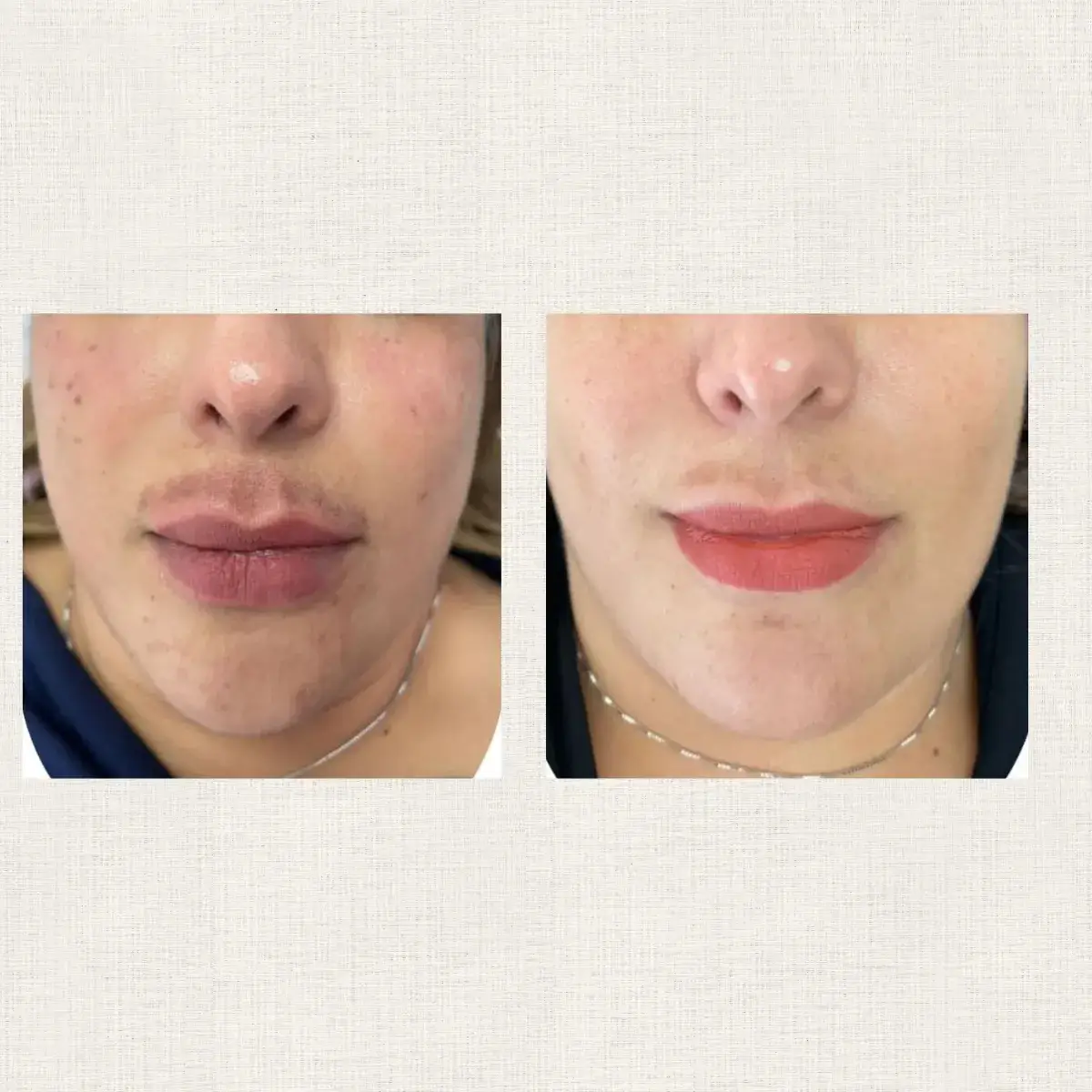 Portfolio Kanea Toulon