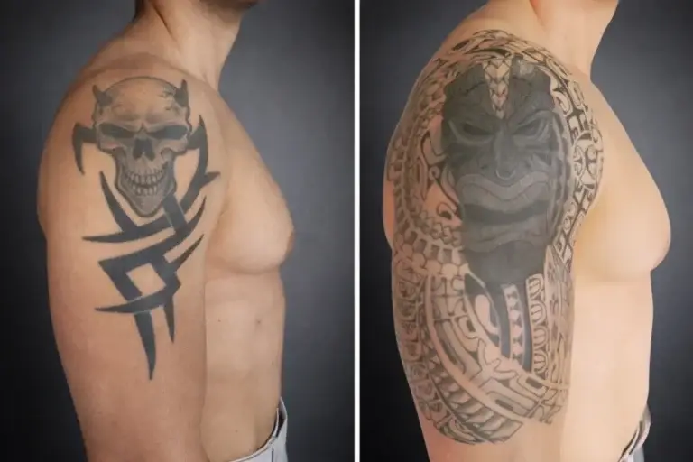 Recouvrement de tatouage à Toulon