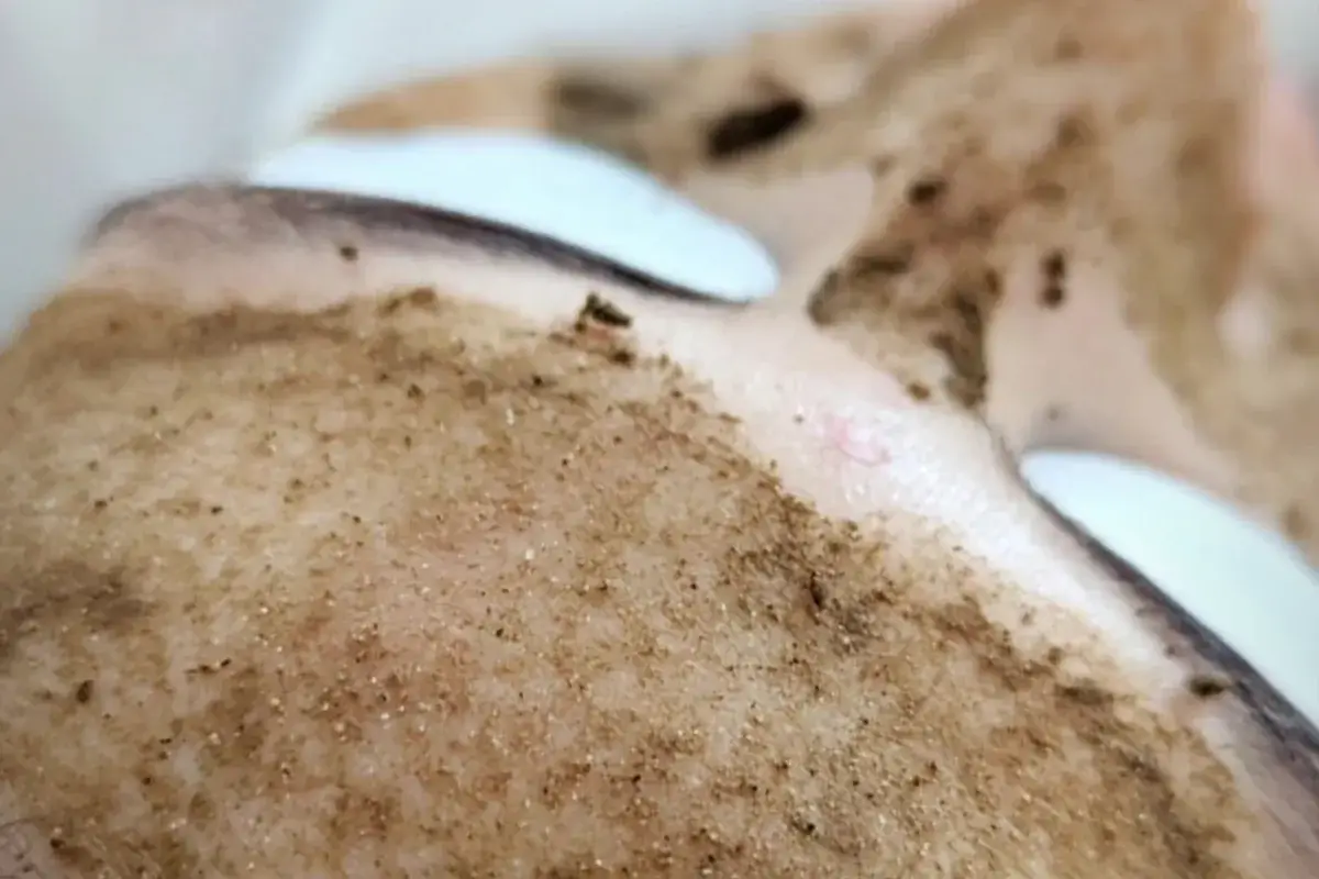 Application du peeling naturel aux spicules sur le visage pour atténuer la ride du lion à Toulon Kanea