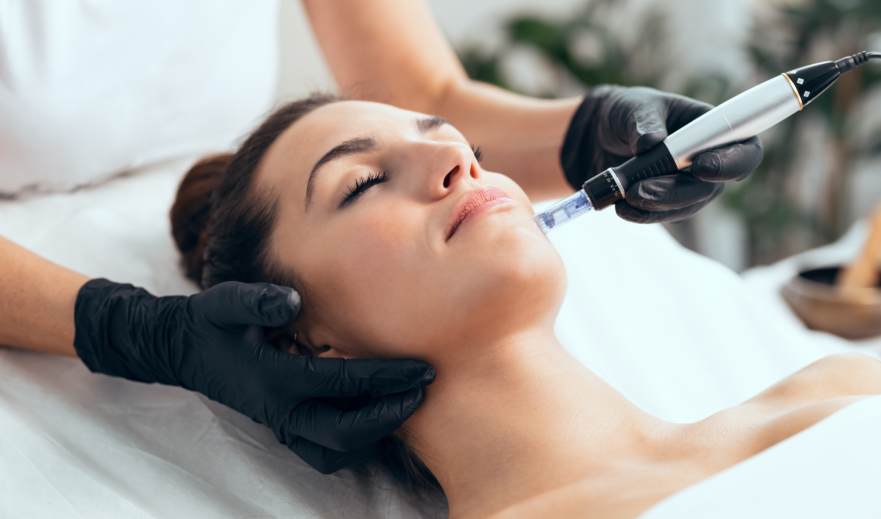 Soin de Microneedling du visage d'une femme sur la joue