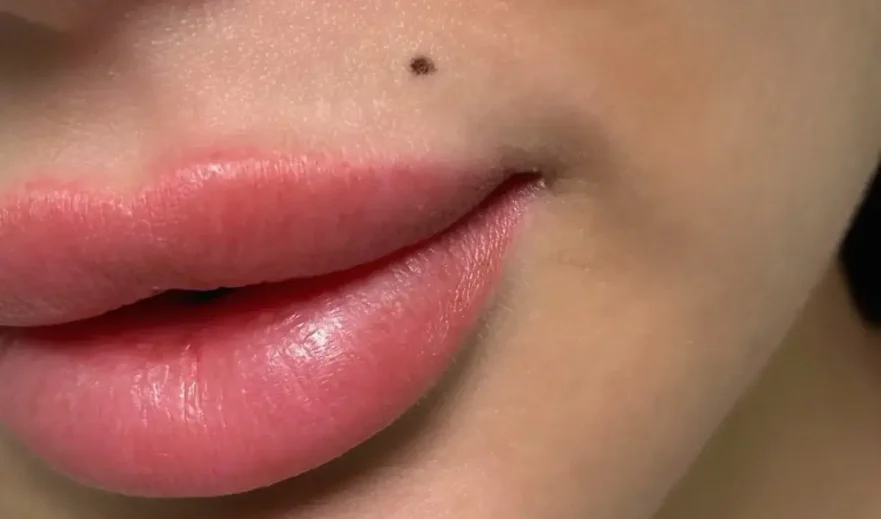 Maquillage permanent grain de beauté en cours à Toulon : pose au dermographe avec pigments médicaux Biotic Phocéa, geste de précision sur-mesure
