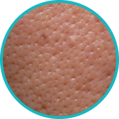 Peeling naturel pour resserrer les pores dilatés — Kanea, Toulon