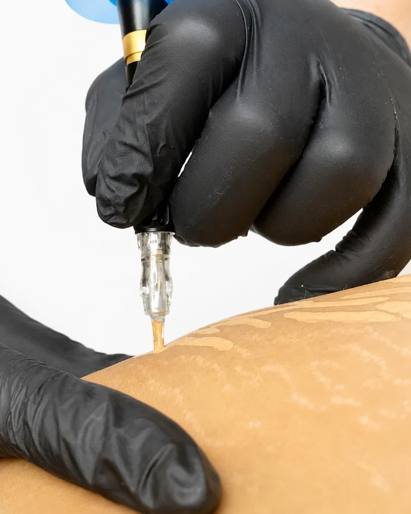 Nano-pigmentation de la peau à la machine, soin à Toulon